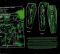Платівка Type O Negative – Dead Again|Тип O Негативний-Знову мертвий(2xLP)